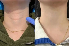 【2026.1.30】王鹤棣待爆帝？任宥纶郑合惠子？明星怎么祛颈纹？蒋欣和叶祖新？牢A的爆火对圈里有影响？