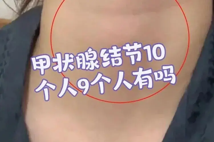 最近总在刷到李昕季烨和朱美吉很好磕,想知道他俩在一起了 第6张 最近总在刷到李昕季烨和朱美吉很好磕,想知道他俩在一起了 第6张