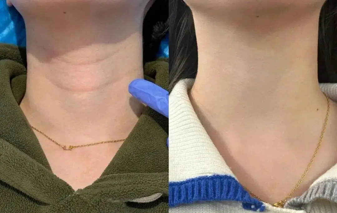 【2026.1.30】王鹤棣待爆帝?任宥纶郑合惠子?明星怎么祛颈纹?蒋欣和叶祖新?牢A的爆火对圈里有影响? 第1张 【2026.1.30】王鹤棣待爆帝?任宥纶郑合惠子?明星怎么祛颈纹?蒋欣和叶祖新?牢A的爆火对圈里有影响? 第1张